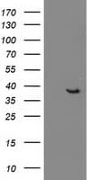 DNAJB1 / Hsp40 Antibody (clone OTI1E10)