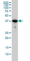 IHC-plus™ MAPK13 / p38delta Antibody (clone 2B2)