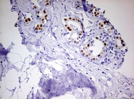 PR / Progesterone Receptor Antibody (aa1-298, clone OTI4B3)