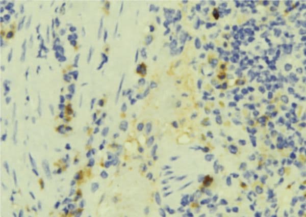 IFT57 / HIPPI Antibody