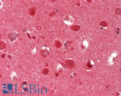 IHC-plus™ PSMA5 Antibody