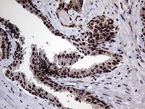 PPP4C Antibody (clone OTI2E4)