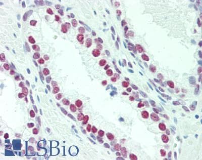 IHC-plus™ NOL4 Antibody (clone 2A10)
