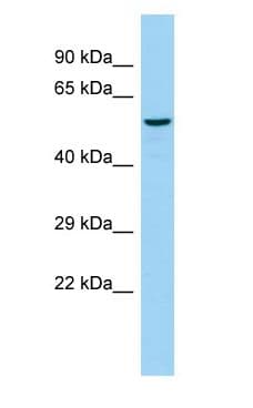 ST8SIA4 Antibody (C-Terminus)