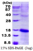 Human KLRC2 / NKG2C / CD159c Protein (Recombinant His)