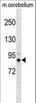 NAK / TBK1 Antibody (aa8-35)