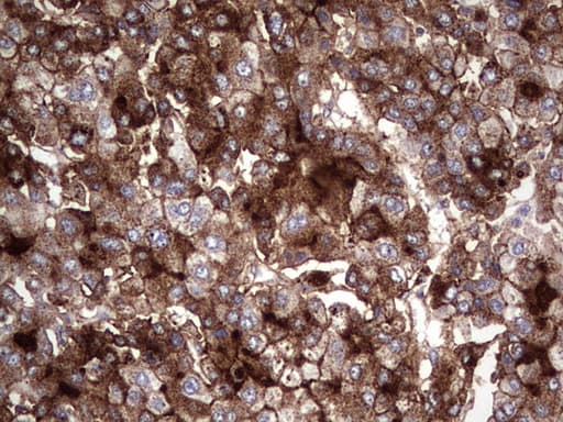 Monoclonal Mouse anti-Human SQSTM1 Antibody (clone UMAB13, IHC, IF, WB)