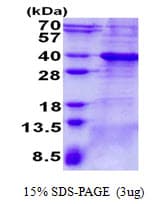 Human BCL7A Protein (Recombinant His)