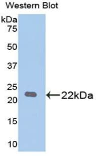 PARK7 / DJ-1 Antibody (aa1-189)