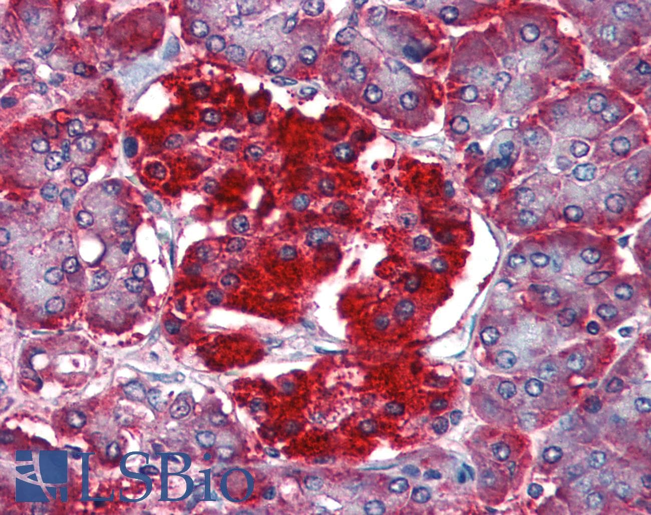 IHC-plus™ RBP4 Antibody (aa19-201, clone AT2B4)