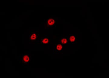 CCNE1 / Cyclin E1 Antibody (phospho-Thr395)