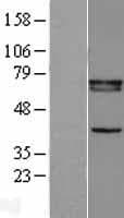 RXRB Protein (Over-Expression Lysate Myc-DDK (Flag))