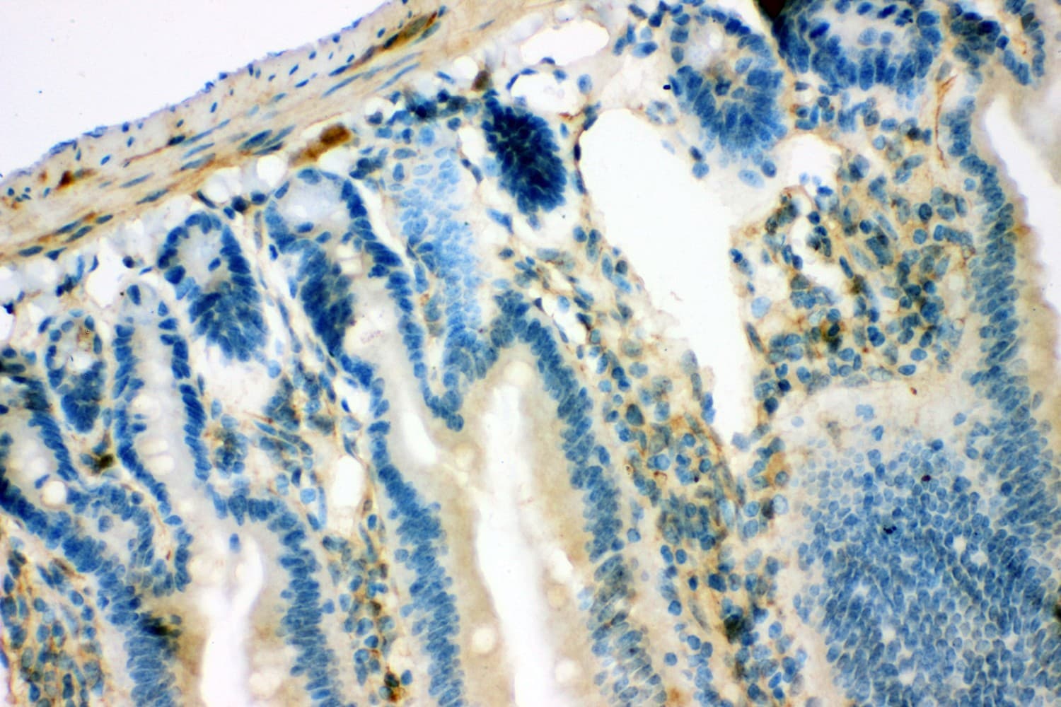 IRS1 Antibody (aa1041-1242)