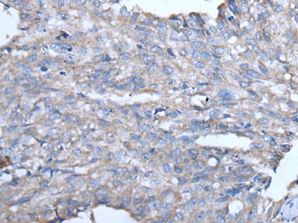 Polyclonal Rabbit anti-Human GJA1 / CX43 / Connexin 43 Antibody (IHC)