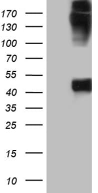 KRT35 / Keratin 35 / KRTHA5 Antibody (clone OTI1A11)