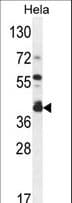 DEGS2 Antibody (aa261-290)