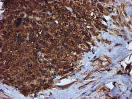 Complement C1s Antibody (clone OTI4E3)