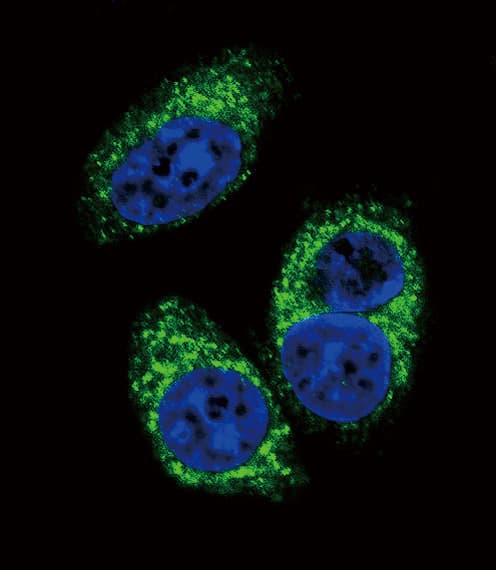 TGFB2 / TGF Beta2 Antibody