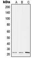 RPL17 / Ribosomal Protein L17 Antibody (Internal)