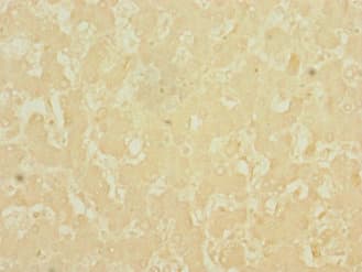 LSD / DNASE1L3 Antibody