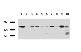 R1 / RRM1 Antibody (aa541-792, clone UMAB165)