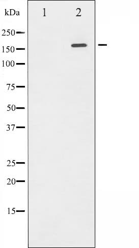 Polyclonal Rabbit anti-Human EGFR Antibody (phospho-Tyr1110, IF, WB)