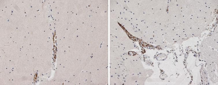 NPY4R / PPYR1 Antibody