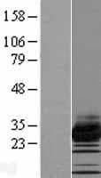 TMEM182 Protein (Over-Expression Lysate Myc-DDK (Flag))