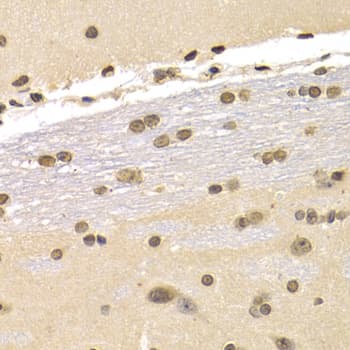 Polyclonal Rabbit anti-Human CDKN1B / p27 Kip1 Antibody (IHC, IF, WB)
