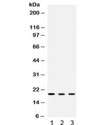 CFL2 / Cofilin 2 Antibody