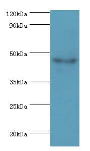 HYAL3 Antibody (aa198-417)