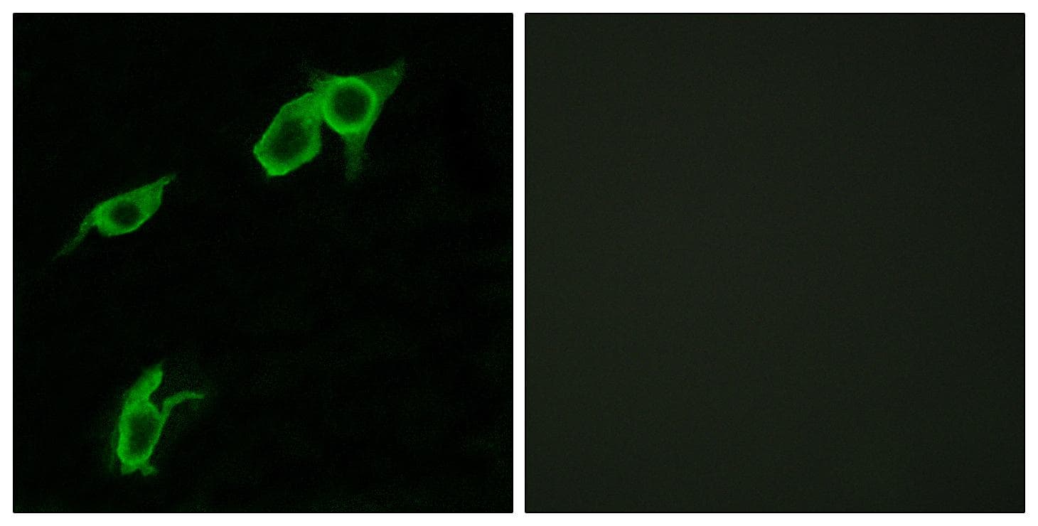 Polyclonal Rabbit anti-Human GPR75 Antibody (IF, WB)