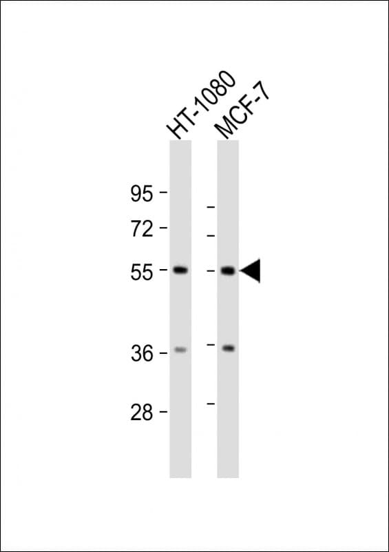 TMEM184C Antibody (aa407-438)