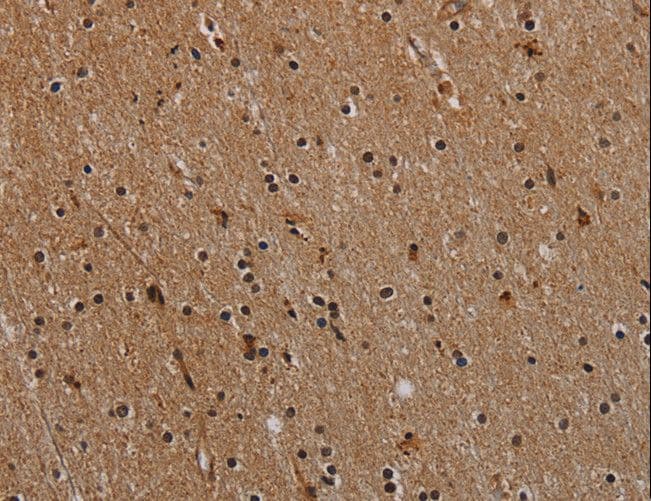 NLRP9 Antibody