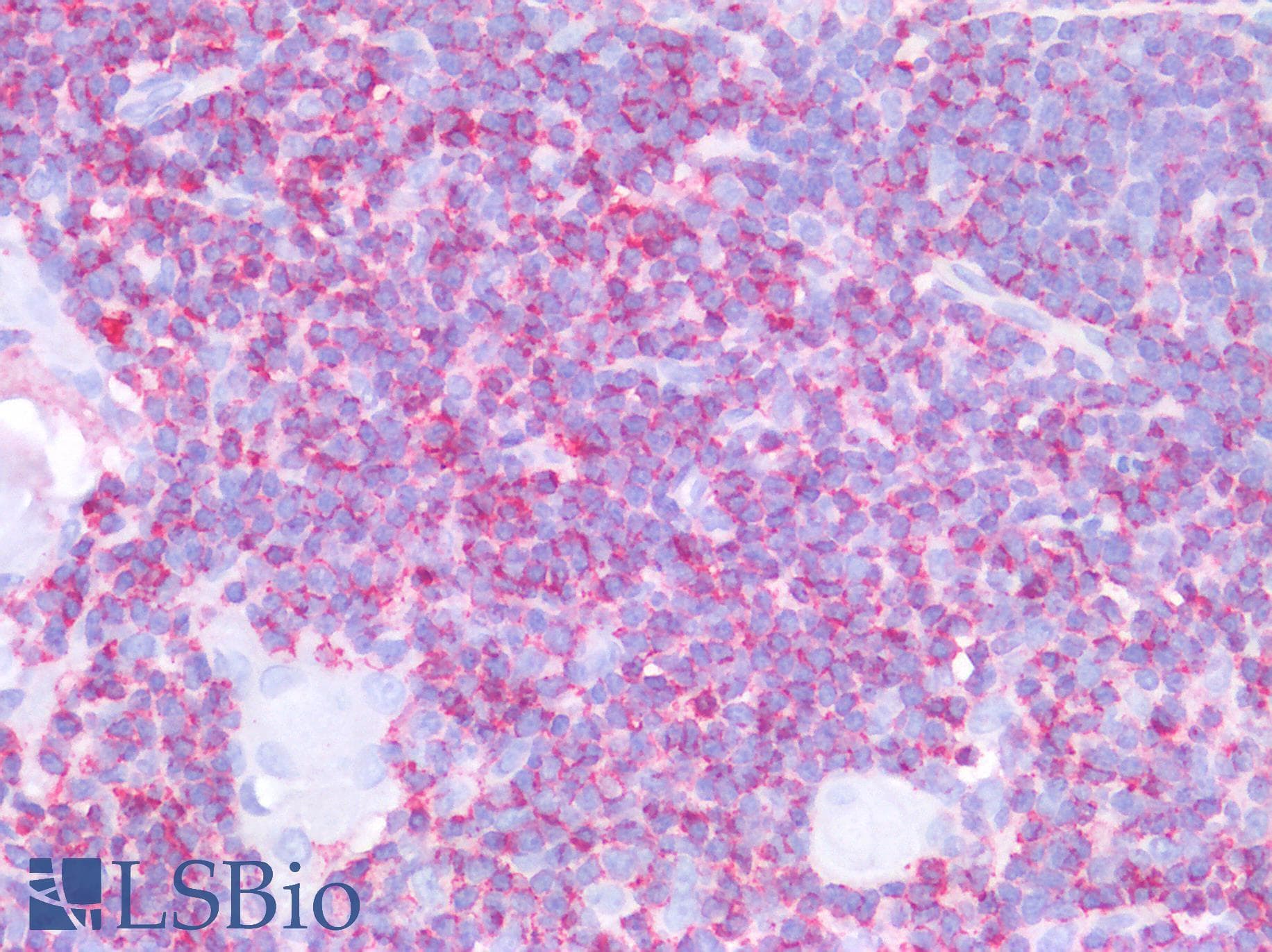 IHC-plus™ Polyclonal Rabbit anti-Human CD45 / LCA Antibody (IHC, WB)