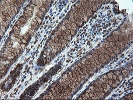 STK38L / NDR2 Antibody (clone OTI4D8)