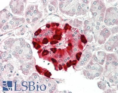 CLU / Clusterin Antibody (aa71-99, PE)