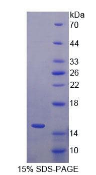 Human S100A7A / S100A15 Protein (Recombinant His-T7)