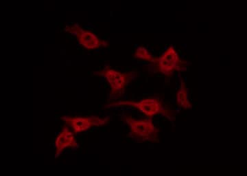 FAK / Focal Adhesion Kinase Antibody (phospho-Tyr576)