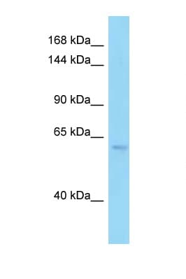 Polyclonal Rabbit anti-Human PDE6B / PDE6 Beta Antibody (aa372-421, WB)
