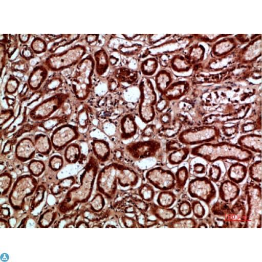 NAPSA / NAPA / Napsin A Antibody