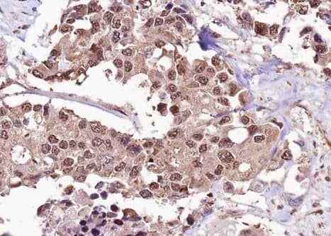 Polyclonal Rabbit anti-Human FOXO1 / FKHR Antibody (phospho-Ser256, IHC, IF, WB)