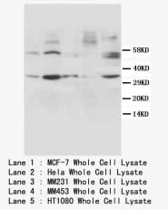 CCND1 / Cyclin D1 Antibody (N-Terminus)