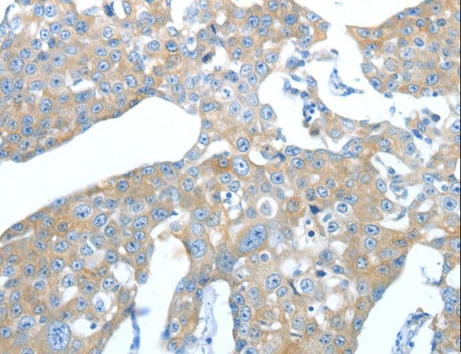 AMPH / Amphiphysin Antibody