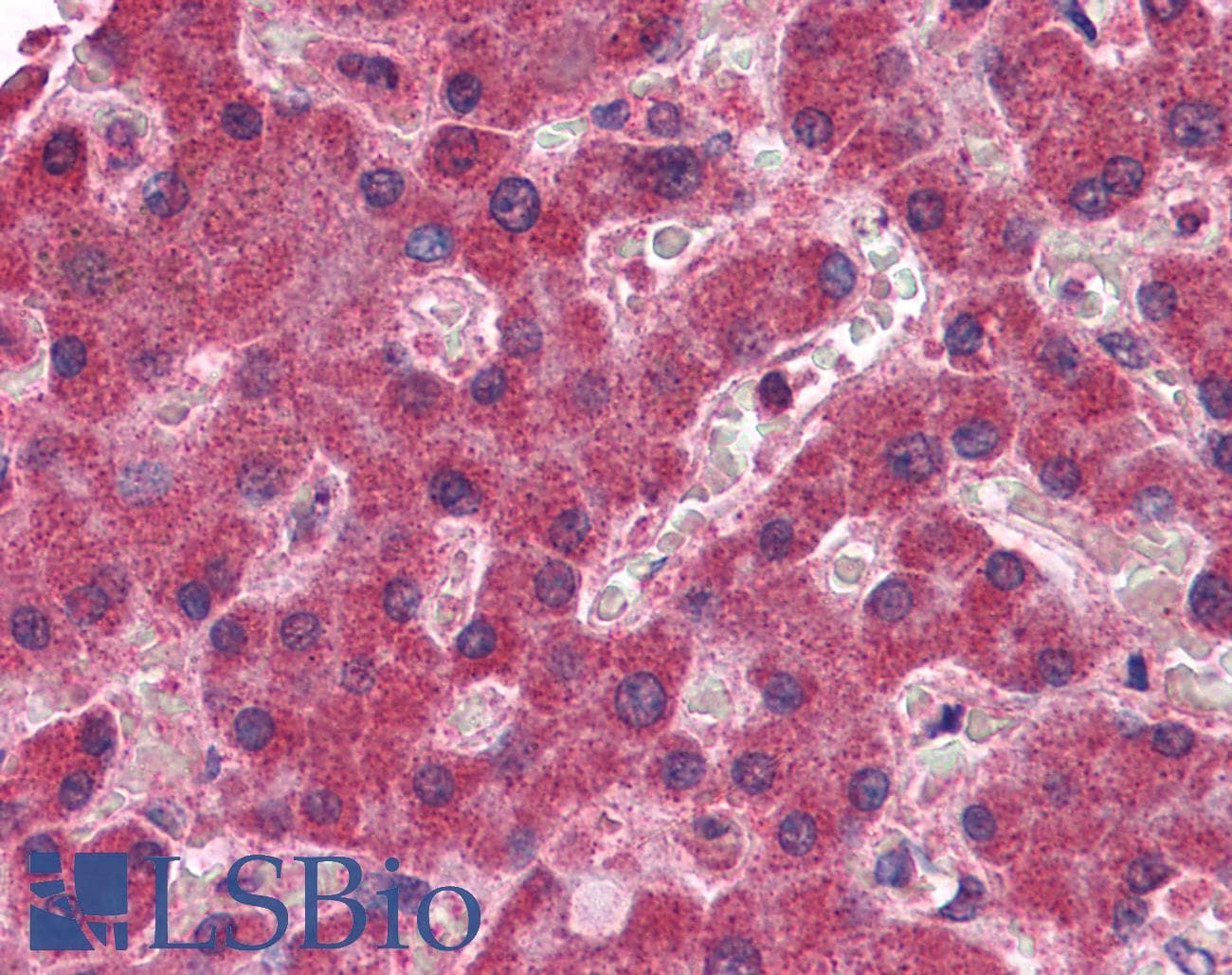 IHC-plus™ Polyclonal Goat anti-Human MGLL / Monoacylglycerol Lipase Antibody (aa17-29, IHC, WB)