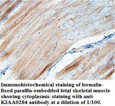 Polyclonal Rabbit anti-Human KIAA0284 Antibody (aa1444-1583, IHC, WB)