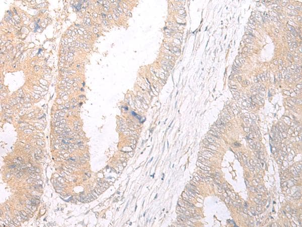 HLA-C Antibody