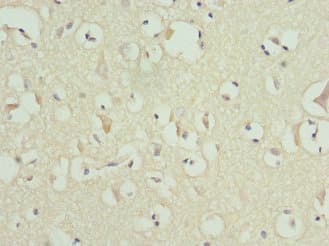 MATK Antibody