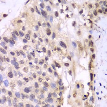 Polyclonal Rabbit anti-Human PSMA6 Antibody (IHC, IF, WB)