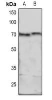 MARCKS Antibody